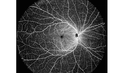 Adanced Dream Dream Dream Oct Sweept Source Imaging Technology получает марку CE